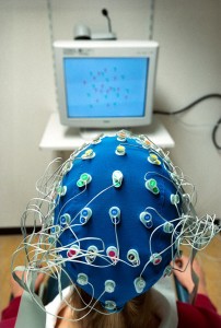 Illustration: electrodes on someone's scalp