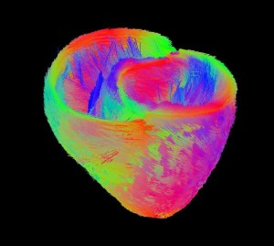 Average model of fibers in the heart
