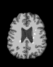 reseach_MS_segm