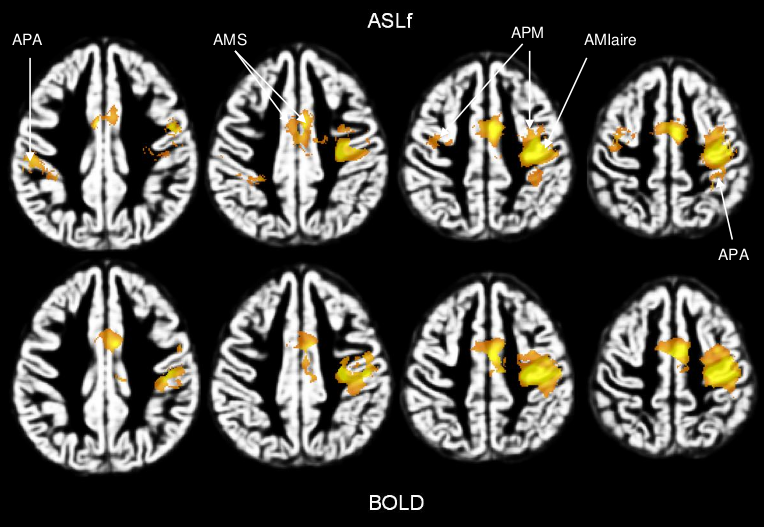 research_ASL_fasl_bold