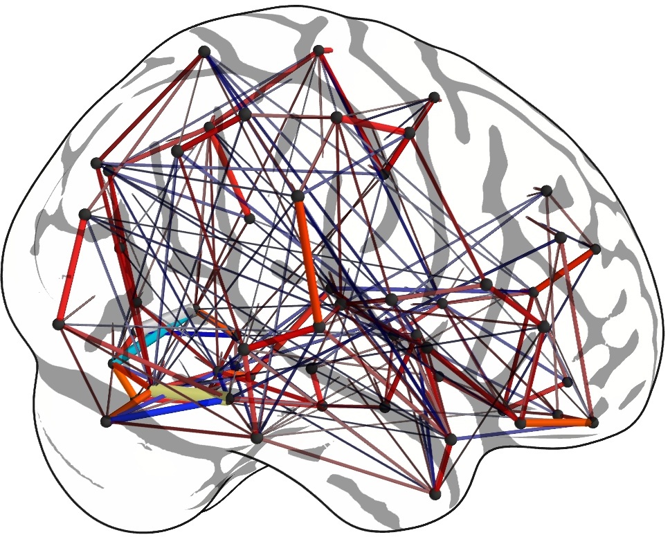 Covariance and graphical models of brain connectivity – Parietal