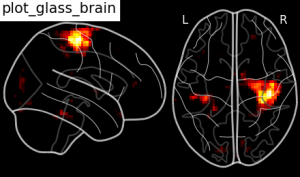 plot_glass_brain