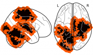 Spatial tolerance in the case of fMRI data: Expanding weight maps by 6 voxels (12 mm). The black-colored voxels represent the initial non zero weights of the reference map. The red-colored voxels are the δ-dilation of the previous map where δ = 6 voxels.