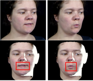 Expression-preserving face frontalization improves visually assisted speech processing